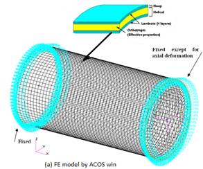 Study of Post Buckling Behavior of Carbon-Epoxy Composite Pressure Vessel Subjected to Hydrostatic Pressure
